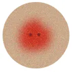 gebeten of gestoken? Herken een spinnenbeet en weet wat je kunt doen om deze te behandelen.